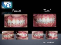 /album/casos-clinicos1/m-guimar%c3%a3es-jpg2/